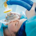 Doctor on TikTok Says Be Honest About Smoking Weed Before Anesthesia