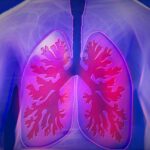 Is Smoking Marijuana Bad For Your Lungs